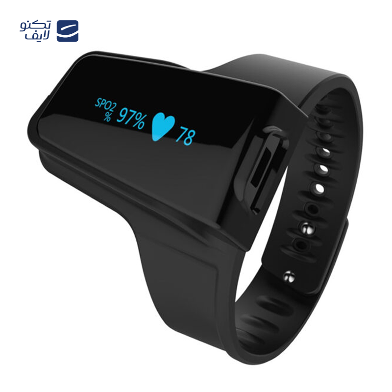 gallery-پالس اکسیمتر ولو مدل Checkme O2 copy.png gallery-پالس اکسیمتر ولو مدل Checkme O2 copy.png