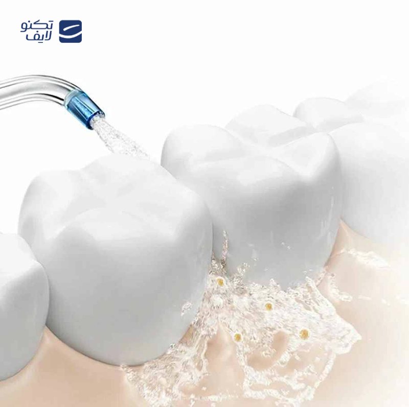 gallery-دستگاه شستشوی دهان و دندان ان شن مدل Mint 3 copy.png