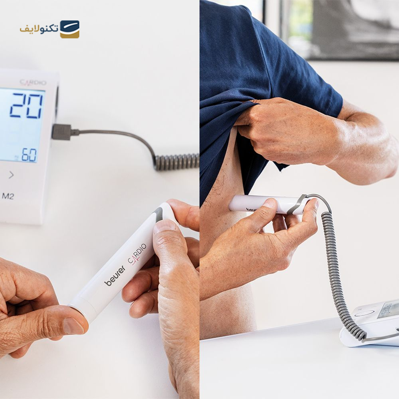 gallery-فشارسنج دیجیتال بیورر مدل BM 85 copy.png gallery-فشارسنج دیجیتال بیورر مدل BM 85 copy.png
